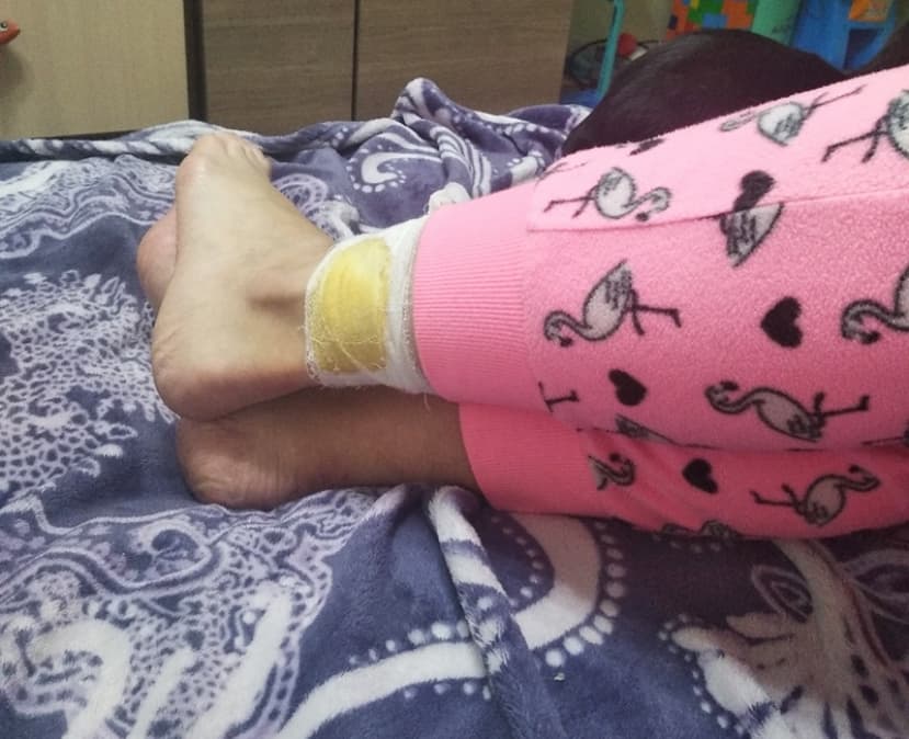 Лидчанку покусала бродячая собака