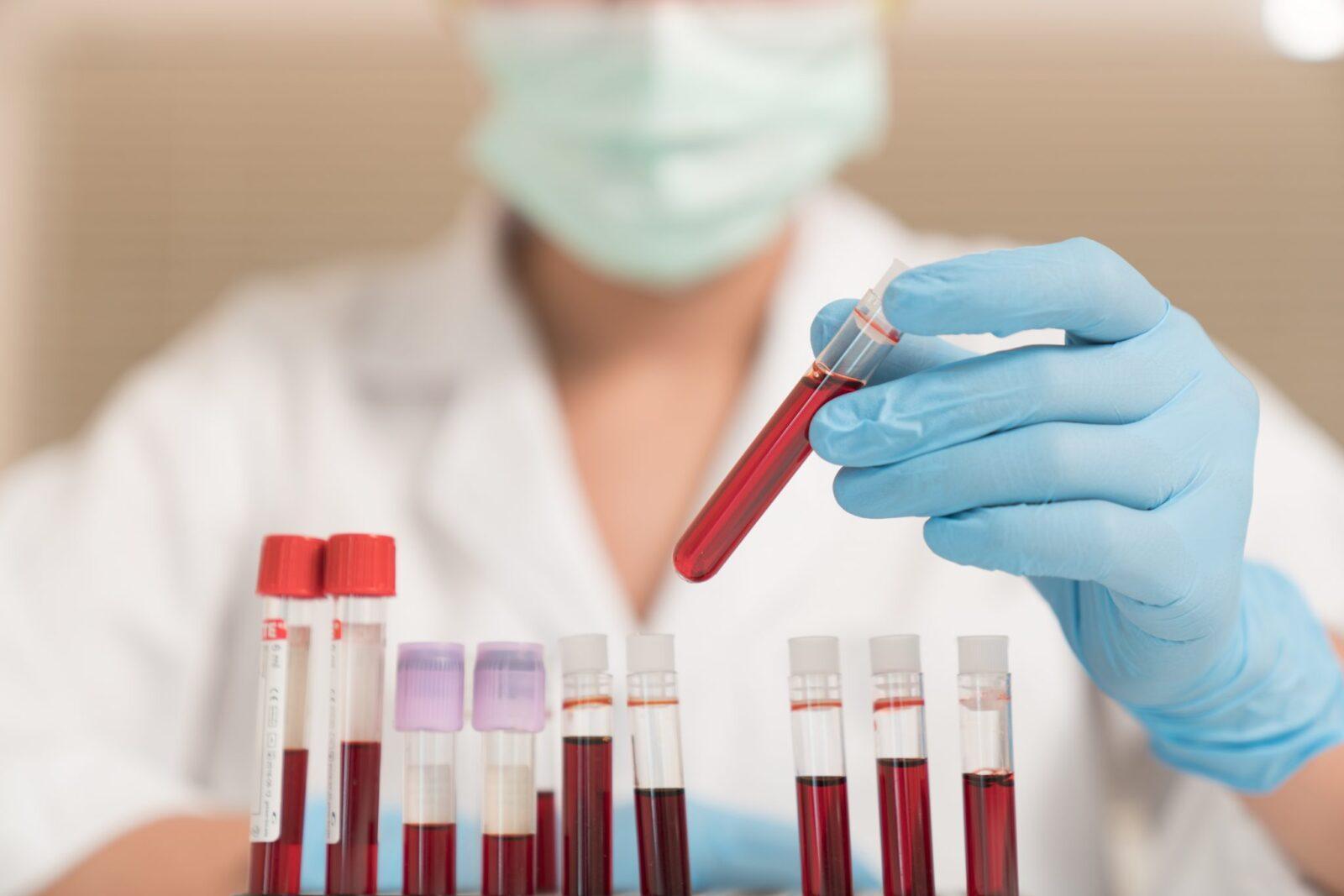 Сдача крови и анемия: мифы и реальность от врача-специалиста